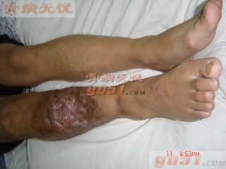 点此在新窗口浏览图片