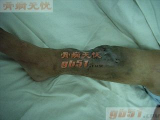 点此在新窗口浏览图片