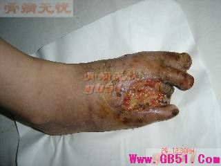 点此在新窗口浏览图片